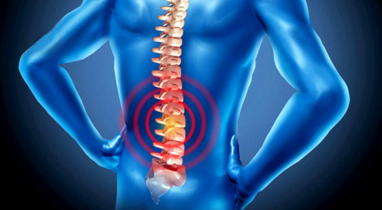 Vật lý trị liệu thoái hóa cột sống lưng có hiệu quả không?