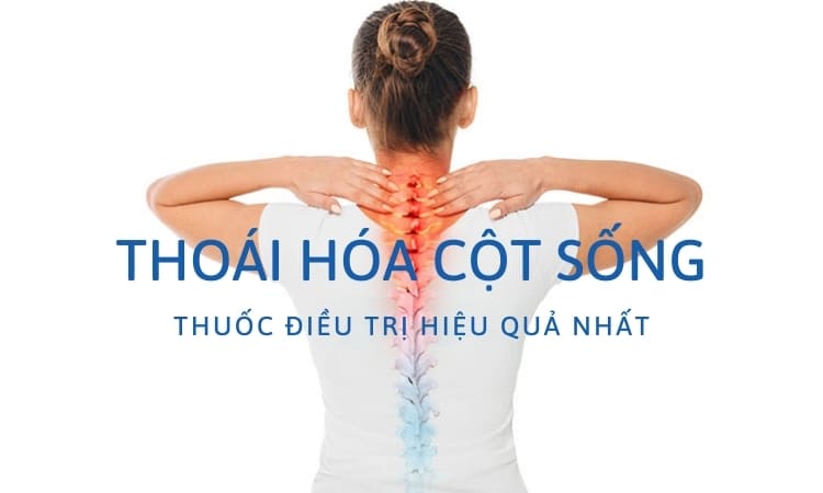 thoai-hoa-cot-song-uong-thuoc-gi
