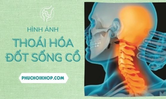 hinh-anh-thoai-hoa-dot-song-co